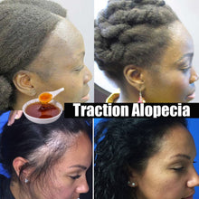 Load image into Gallery viewer, Africa Wild Rosemary Oil Crazy Hair Growth Traction Alopecia Chebe Powder Hair Loss Regrow your Edges Bald Spots Thinnin Hair
